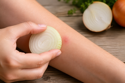 Fresh onion being applied to a bee or wasp sting as a traditional home remedy.